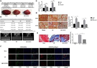 Cardiac Shock Wave Therapy Improves Ventricular Function by Relieving Fibrosis Through PI3K/Akt Signaling Pathway: Evidence From a Rat Model of Post-infarction Heart Failure